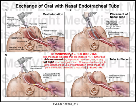 Oral Tube 60