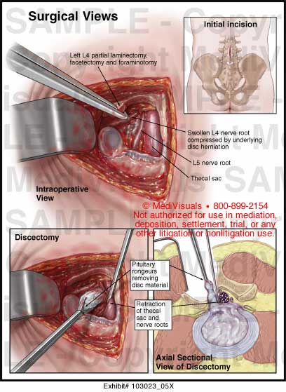 Medivisuals Surgical Views Medical Illustration