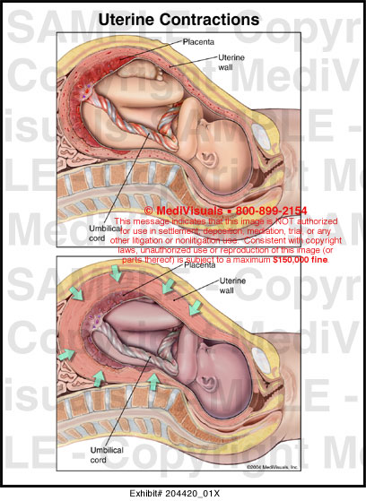 Uterine Contractions Medical Illustration Medivisuals