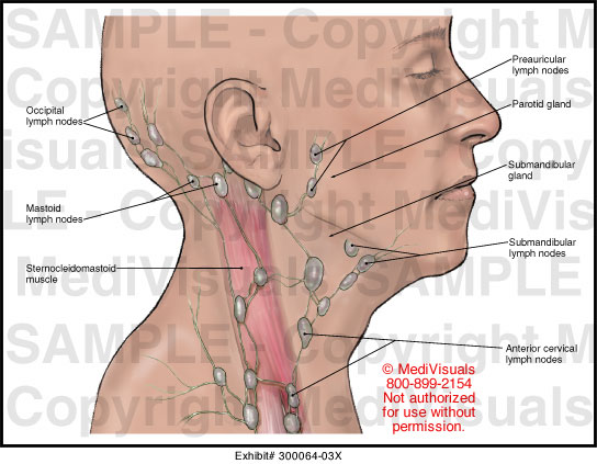 hard lymph nodes back of neck