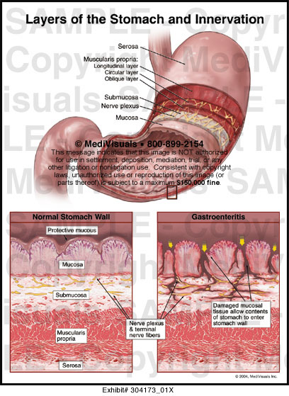 Layers of the Stomach and Innervation Medical Exhibit Medivisuals