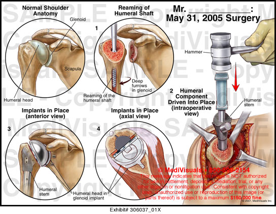 May 31, 2005 Surgery Medical Exhibit