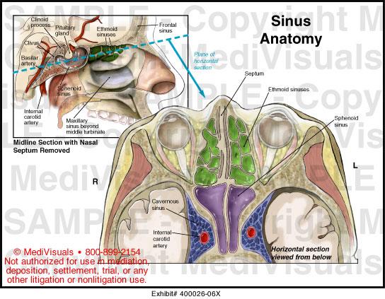 Medivisuals Sinus Anatomy Medical Illustration