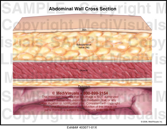 Abdominal Wall Cross Section Medical Illustration Medivisuals