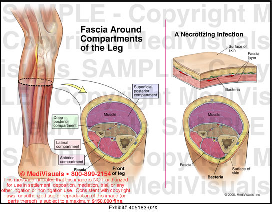 Fascia Around Compartments of the Leg Medical Exhibit Medivisuals