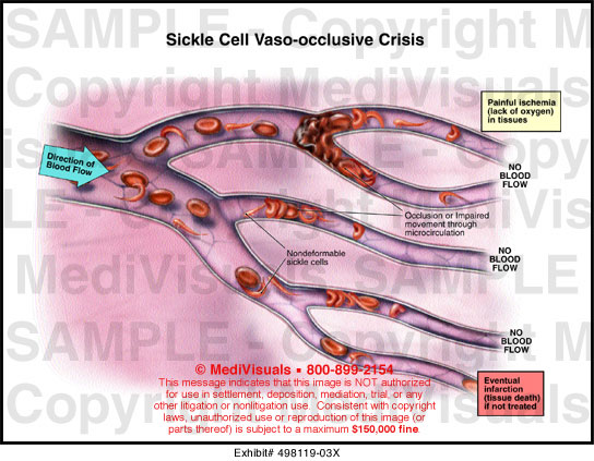 occlusive - definition - What is