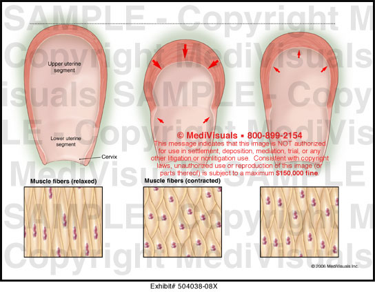 uterine-contractions-medivisuals-medical-exhibit