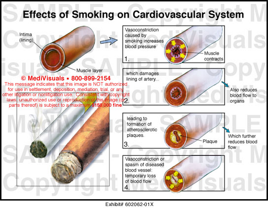 essay on the effects of smoking on the cardiovascular system