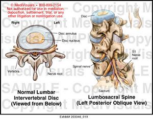 Lumbosacral Spine Medical Illustration