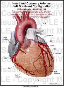 Heart And Coronary Arteries: Left Dominant Configuration Medivisuals