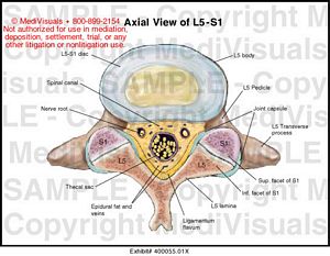 Axial View of L5-S1 Medical Illustration Medivisuals