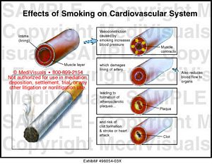 essay on the effects of smoking on the cardiovascular system