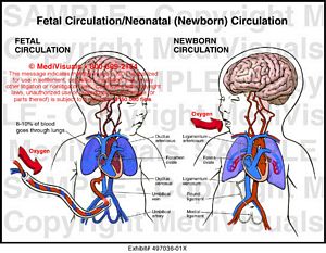 Fetal Circulation/Neonatal (Newborn) Circulation Medical Exhibit