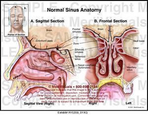 Normal Sinus Anatomy MediVisuals Medical Illustration