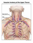 Vascular Anatomy of the Upper Thorax Medical Exhibit Medivisuals