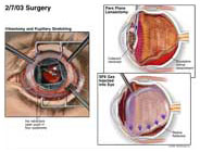 Medivisuals Surgery Medical Illustration