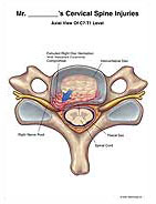 cervical spine