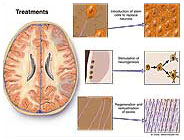 Treatments Medical Illustration Medivisuals